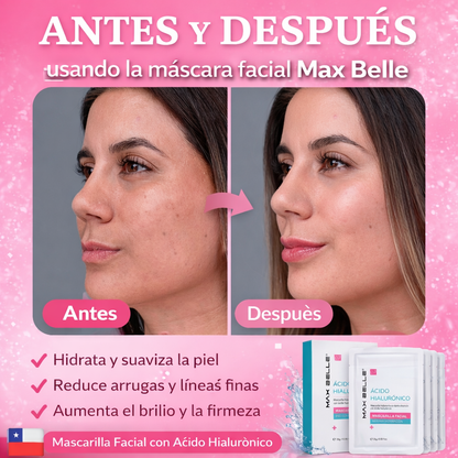 MASCARILLA FACIAL MAX BELLE X5